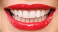 Sở hữu hàm răng trắng sáng chưa chắc đã tốt?