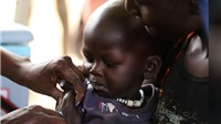 117 triệu trẻ em bị lỡ tiêm chủng sởi vì Covid-19
