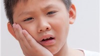 10 thảo dược trị đau răng hiệu quả