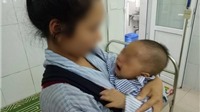 Mẹ nhỏ sữa chữa đau mắt, con 7 tháng tuổi bị hỏng giác mạc