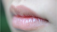 5 dấu hiệu bất thường ở môi bạn không thể bỏ qua