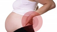 Bí quyết khắc phục chứng đau lưng khi mang thai