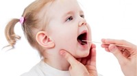 Trẻ bị viêm amidan có nên cắt hay không?