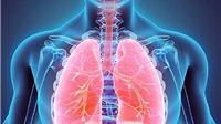 Bộ Y tế cảnh báo người dân phòng chống dịch viêm phổi lạ