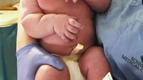 Bé trai sơ sinh có cân nặng lên tới 7,3kg, bằng kích cỡ trẻ 6 tháng tuổi