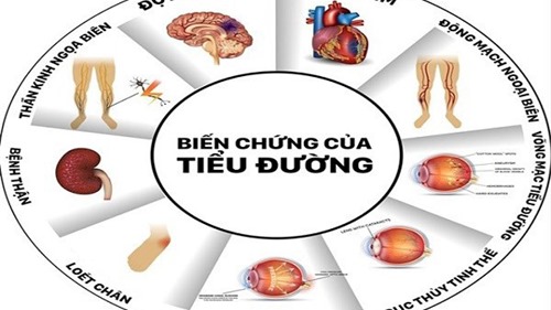 70% người Việt không biết mình mắc bệnh tiểu đường