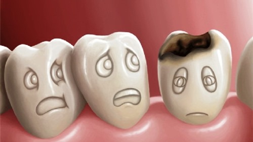 Những bệnh cực nguy hiểm về răng miệng bạn dễ mắc phải