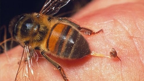 Làm gì khi bị ong đốt?