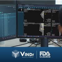  Sản phẩm AI của VinBigdata đạt chứng nhận của FDA