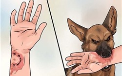 3 bước cần làm ngay khi bị chó cắn để tránh lây bệnh dại