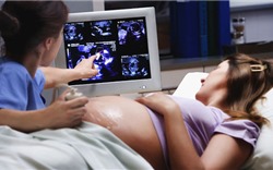 Phân biệt các loại siêu âm 2D, 3D và 4D khi mang thai 