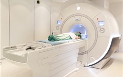 Đột quỵ não và vai trò của chụp cộng hưởng từ (MRI) trong tầm soát đột quỵ