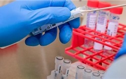 Việt Nam tiến hành thử nghiệm vaccine phòng bệnh COVID -19