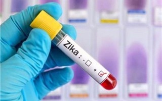 Vĩnh Long đã có trường hợp nhiễm virus Zika đầu tiên