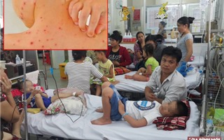 Tất cả các quận, huyện ở Hà Nội đều đã có bệnh nhân mắc sởi, sốt xuất huyết