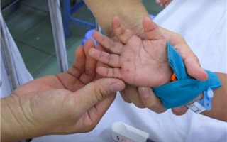 Quảng Ngãi: Gia tăng bệnh tay chân miệng, hơn 900 ca mắc