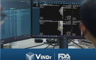  Sản phẩm AI của VinBigdata đạt chứng nhận của FDA